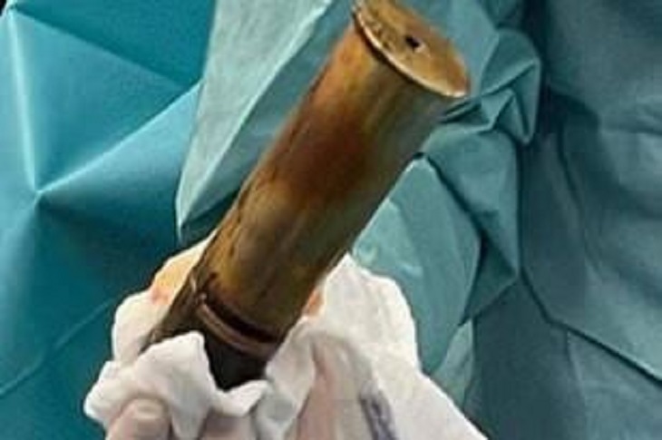 Doctor Curmudgeon® Man Inserts WWI Bomb in Rectum to Intensify Orgasm! What's Next? – RingSide Report - Vimarsana News